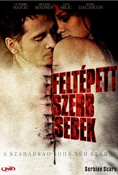 Serbian Scars