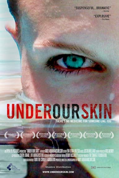 Under Our Skin