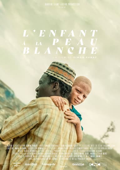 L'enfant à la peau blanche